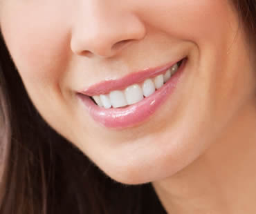 Teeth Whitening vs. Teeth Bleaching: What’s the Difference?